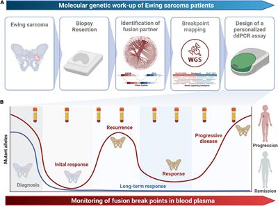 Clinical implementation of plasma cell-free circulating tumor DNA quantification by digital droplet PCR for the monitoring of Ewing sarcoma in children and adolescents